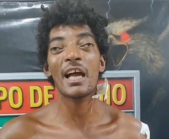 “Mesmo ferida, ele continuou agredindo”, relata família após mulher ser atacada com várias pauladas; VEJA O VÍDEO