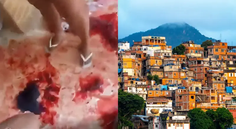 Morador tem couro cabeludo arrancado após ser feito de refém durante operação do Bope