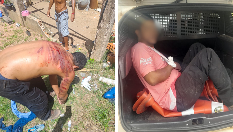 “Foi por ciúmes”, diz homem que arrancou quatro dedos da ex e depois foi espancado em Cuiabá