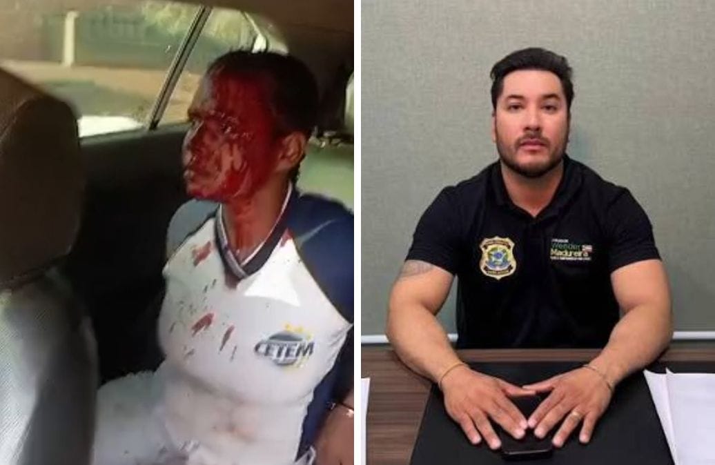 Vereador entra em imóvel para fiscalizar cães e moradora acaba detida em Várzea Grande