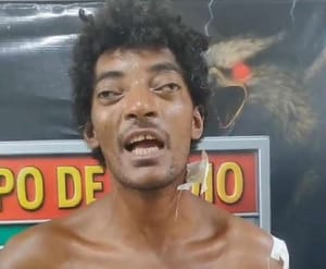 “Mesmo ferida, ele continuou agredindo”, relata família após mulher ser atacada com várias pauladas; VEJA O VÍDEO