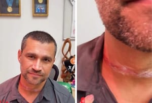 “Isso é um absurdo, pode matar”, diz vereadora após secretário quase ser degolado por fio solto em Cuiabá; VEJA O VÍDEO
