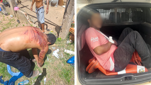 “Foi por ciúmes”, diz homem que arrancou quatro dedos da ex e depois foi espancado em Cuiabá